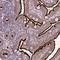 Solute Carrier Family 7 Member 1 antibody, HPA039721, Atlas Antibodies, Immunohistochemistry paraffin image 