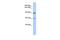 G Protein-Coupled Receptor Associated Sorting Protein 2 antibody, PA5-43854, Invitrogen Antibodies, Western Blot image 