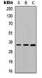 Serpin Family C Member 1 antibody, orb234760, Biorbyt, Western Blot image 