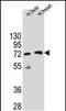 Potassium Channel Tetramerization Domain Containing 8 antibody, PA5-48245, Invitrogen Antibodies, Western Blot image 