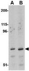 N-Acylsphingosine Amidohydrolase 2 antibody, GTX31775, GeneTex, Western Blot image 