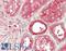 Cbl Proto-Oncogene antibody, LS-B14907, Lifespan Biosciences, Immunohistochemistry paraffin image 