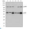 Nuclear Factor Kappa B Subunit 1 antibody, LS-C812720, Lifespan Biosciences, Enzyme Linked Immunosorbent Assay image 