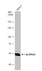 Aldehyde Dehydrogenase 1 Family Member A3 antibody, NBP2-15339, Novus Biologicals, Western Blot image 