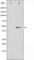 SMAD Family Member 3 antibody, abx011532, Abbexa, Western Blot image 