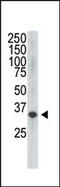 Vascular Endothelial Growth Factor D antibody, LS-C96437, Lifespan Biosciences, Western Blot image 