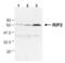 Receptor Interacting Serine/Threonine Kinase 2 antibody, NBP1-97631, Novus Biologicals, Western Blot image 