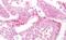 Solute Carrier Family 7 Member 5 antibody, NB110-39037, Novus Biologicals, Immunohistochemistry paraffin image 