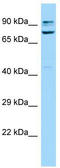 Sorbin And SH3 Domain Containing 1 antibody, TA339964, Origene, Western Blot image 