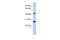 Synaptotagmin 9 antibody, GTX45560, GeneTex, Western Blot image 