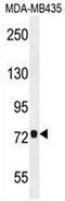 Coiled-Coil Domain Containing 81 antibody, AP50792PU-N, Origene, Western Blot image 