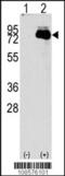NUAK Family Kinase 2 antibody, 62-691, ProSci, Western Blot image 