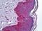 Patatin Like Phospholipase Domain Containing 3 antibody, orb94922, Biorbyt, Immunohistochemistry paraffin image 