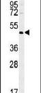 ST3 Beta-Galactoside Alpha-2,3-Sialyltransferase 5 antibody, PA5-25730, Invitrogen Antibodies, Western Blot image 