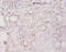 Ro60, Y RNA Binding Protein antibody, LS-C285729, Lifespan Biosciences, Immunohistochemistry paraffin image 