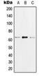Heterogeneous Nuclear Ribonucleoprotein K antibody, orb214045, Biorbyt, Western Blot image 