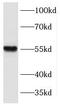 Kruppel Like Factor 5 antibody, FNab04603, FineTest, Western Blot image 