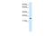 MYCL Proto-Oncogene, BHLH Transcription Factor antibody, GTX48739, GeneTex, Western Blot image 