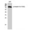 Insulin Receptor antibody, LS-C381260, Lifespan Biosciences, Western Blot image 