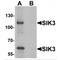 SIK Family Kinase 3 antibody, MBS150059, MyBioSource, Western Blot image 