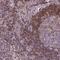 Acyl-CoA Dehydrogenase Family Member 10 antibody, NBP2-49511, Novus Biologicals, Immunohistochemistry paraffin image 