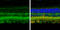 Cellular Retinoic Acid Binding Protein 2 antibody, GTX101551, GeneTex, Immunohistochemistry paraffin image 