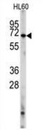 Phosphodiesterase 8A antibody, AP11453PU-N, Origene, Western Blot image 