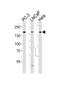 TSC Complex Subunit 2 antibody, MBS9211633, MyBioSource, Western Blot image 