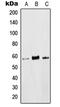 LCK Proto-Oncogene, Src Family Tyrosine Kinase antibody, GTX55100, GeneTex, Western Blot image 