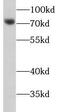 Matrix Metallopeptidase 8 antibody, FNab05246, FineTest, Western Blot image 
