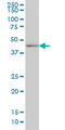 Distal-Less Homeobox 2 antibody, LS-B5396, Lifespan Biosciences, Western Blot image 