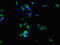 Ribulose-5-Phosphate-3-Epimerase antibody, LS-C397755, Lifespan Biosciences, Immunofluorescence image 