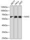 Aladin WD Repeat Nucleoporin antibody, 22-213, ProSci, Western Blot image 