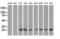 Ras Like Without CAAX 2 antibody, M07833, Boster Biological Technology, Western Blot image 