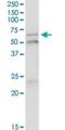 Interferon Regulatory Factor 5 antibody, H00003663-M03, Novus Biologicals, Immunoprecipitation image 