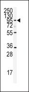 ADAMTS13 antibody, GTX81447, GeneTex, Western Blot image 