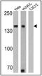 Cadherin 2 antibody, GTX19348, GeneTex, Western Blot image 