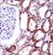 CD70 Molecule antibody, LS-C168561, Lifespan Biosciences, Immunohistochemistry paraffin image 