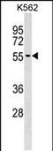 UTP3 Small Subunit Processome Component antibody, PA5-49137, Invitrogen Antibodies, Western Blot image 