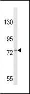 Colony Stimulating Factor 3 Receptor antibody, PA5-26083, Invitrogen Antibodies, Western Blot image 