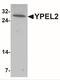 Yippee Like 2 antibody, NBP2-41164, Novus Biologicals, Western Blot image 