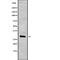 Major Histocompatibility Complex, Class II, DM Alpha antibody, abx215941, Abbexa, Western Blot image 