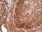 Protein Arginine Methyltransferase 5 antibody, LS-C791257, Lifespan Biosciences, Immunohistochemistry paraffin image 