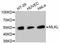 Mixed Lineage Kinase Domain Like Pseudokinase antibody, abx125368, Abbexa, Western Blot image 