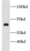 CNKSR Family Member 3 antibody, FNab01799, FineTest, Western Blot image 