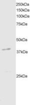 Death Associated Protein Kinase 2 antibody, EB05275, Everest Biotech, Western Blot image 