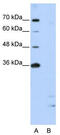 Peptidylprolyl Isomerase E antibody, TA345946, Origene, Western Blot image 