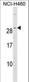 RAS Like Proto-Oncogene A antibody, LS-C158798, Lifespan Biosciences, Western Blot image 