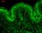 Calcium/Calmodulin Dependent Protein Kinase II Alpha antibody, M03241-1, Boster Biological Technology, Immunohistochemistry paraffin image 