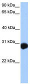 SLAM Family Member 6 antibody, TA342074, Origene, Western Blot image 